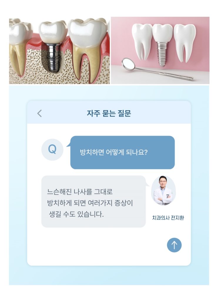 부산치과 임플란트 이미지 (10)