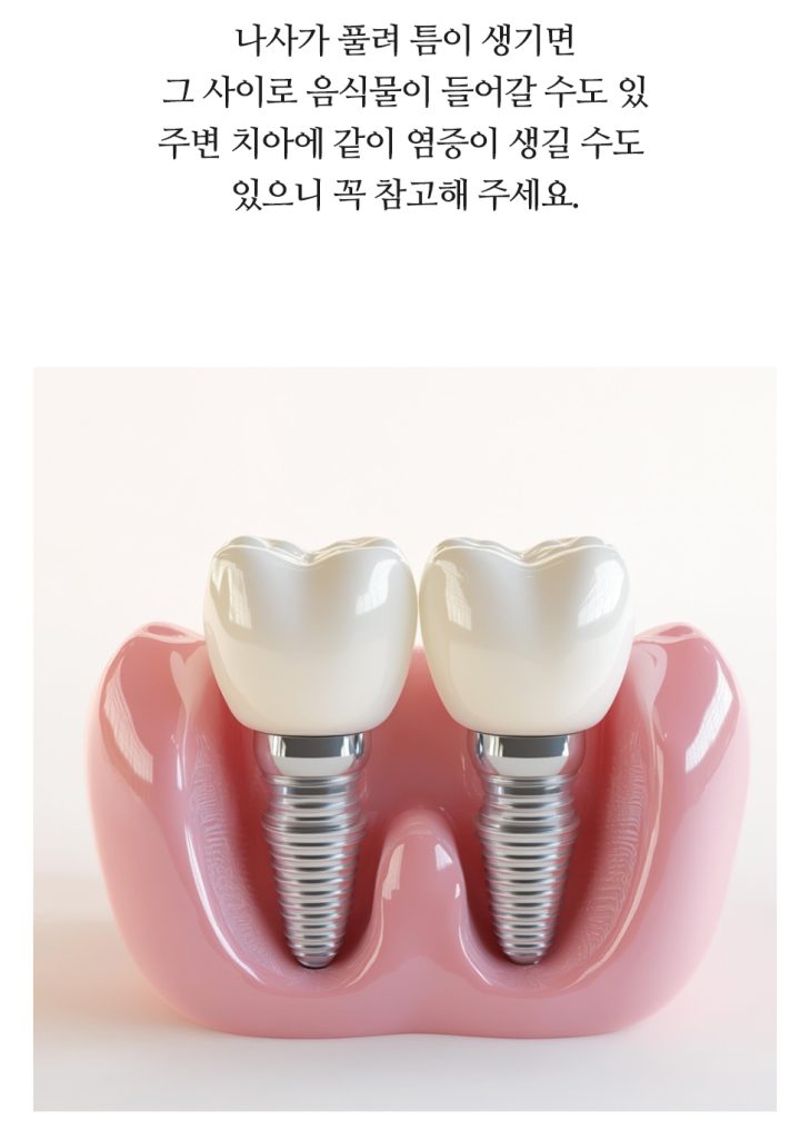 부산치과 임플란트 이미지 (12)