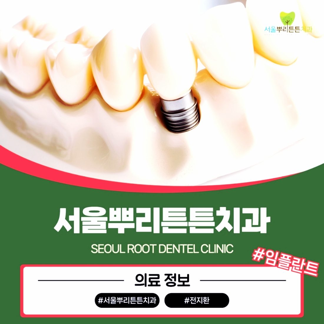 센텀치과 임플란트가격