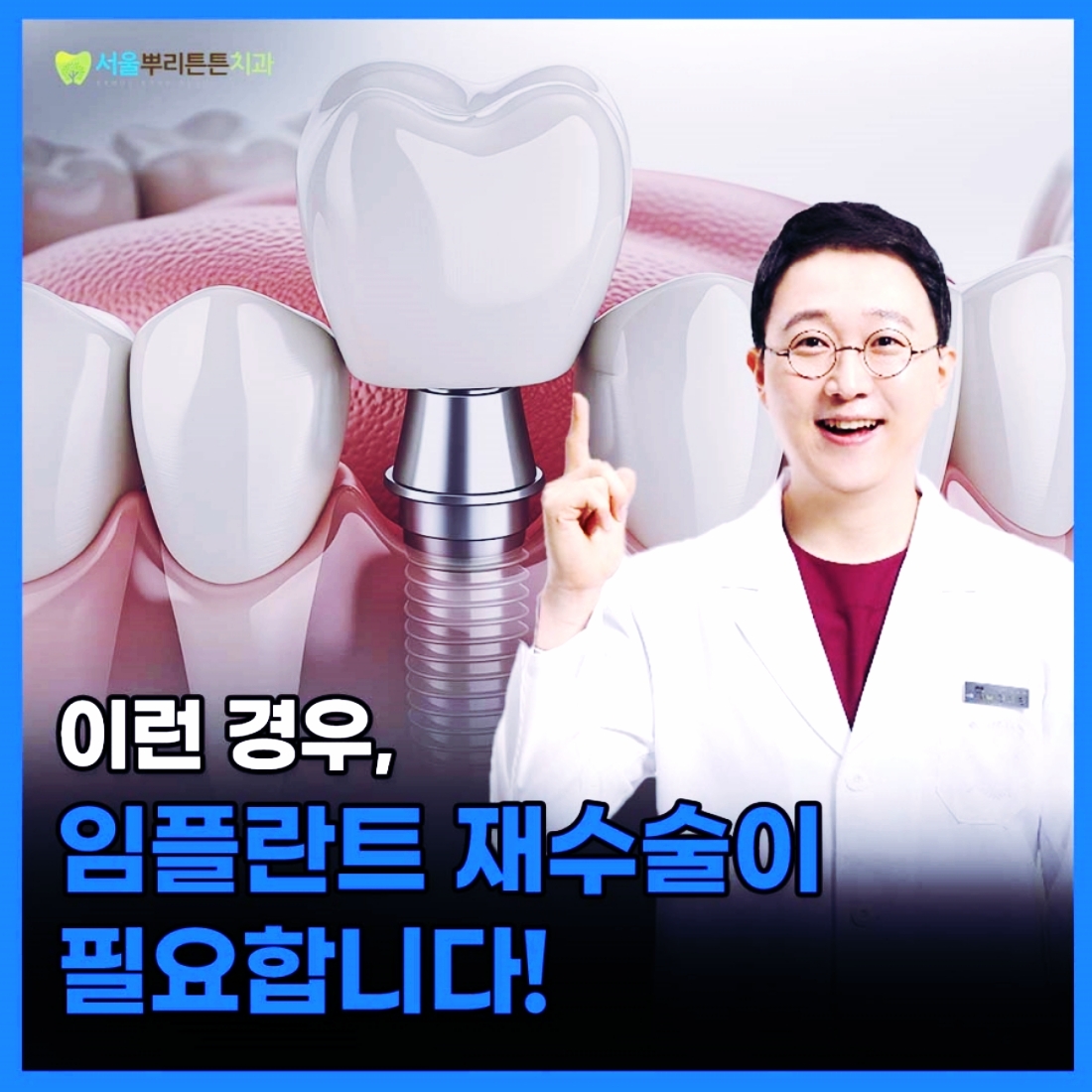 부산치과 임플란트 잘하는곳 소개
