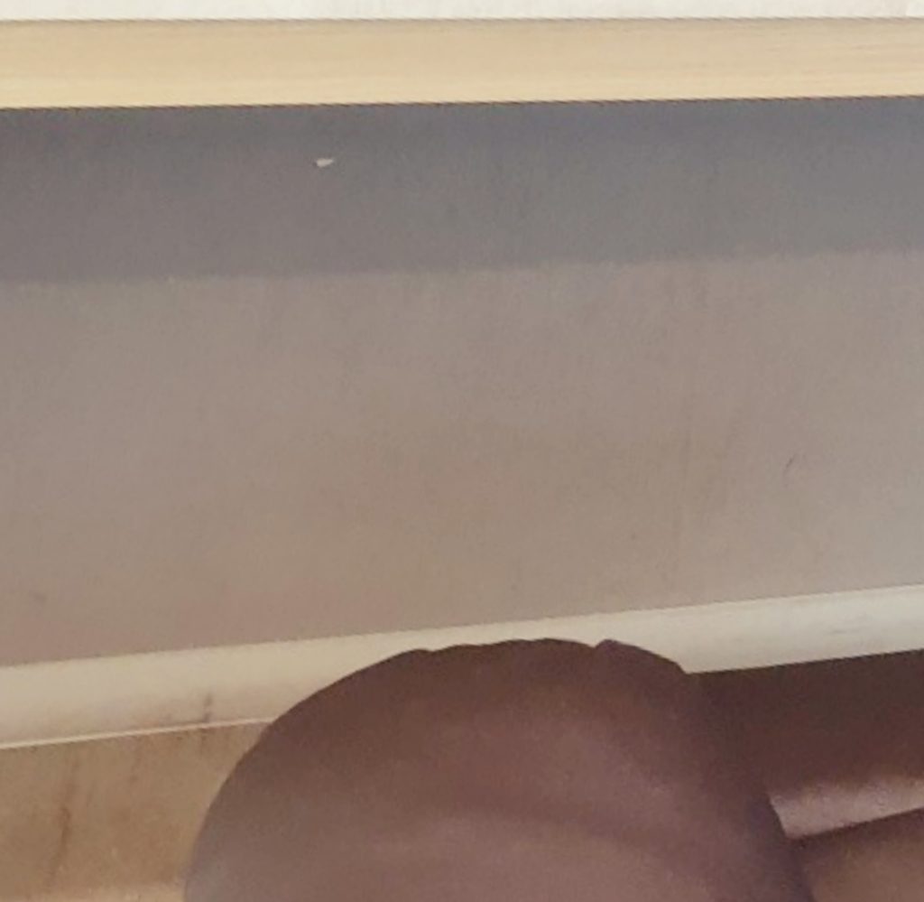 부산치과잘하는곳 (4)