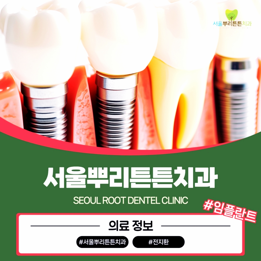 서면치과추천 임플란트치과