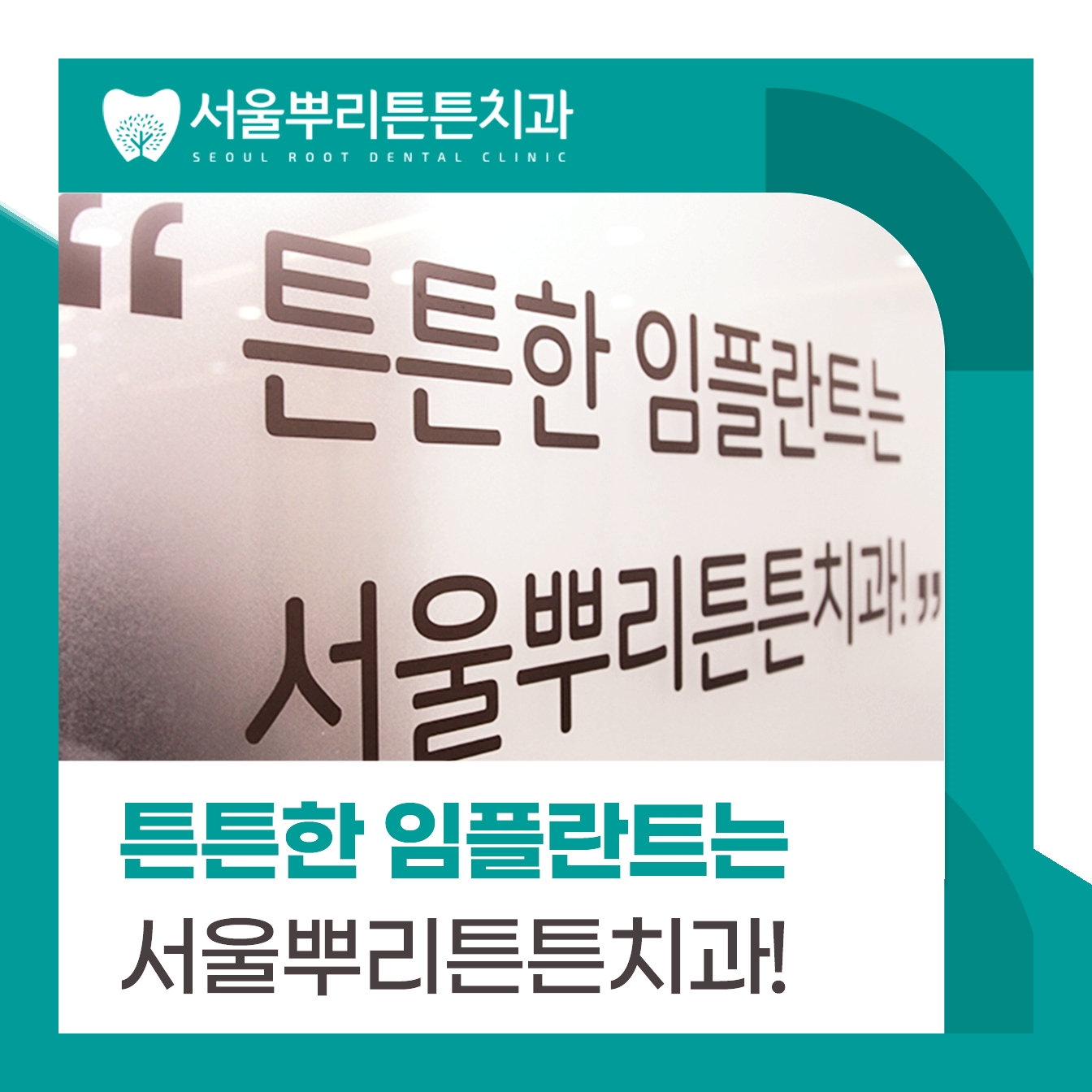 부산 서면 서면역 치과 임플란트잘하는곳
