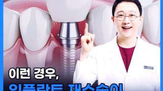 부산치과 임플란트 잘하는곳 소개