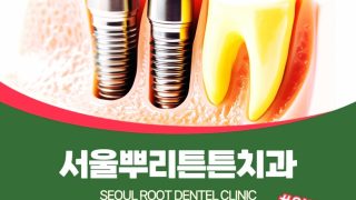 연산동 연산역 치과 임플란트 비용